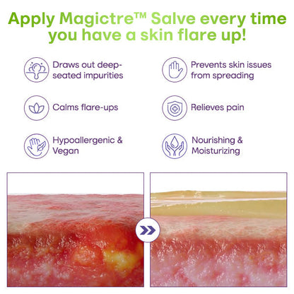 Magictre™ Ultimate Skin Solution Salve