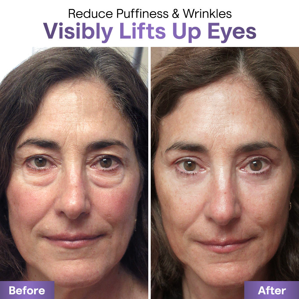 60 seconds to results - Liascy™ Eyebag Cream