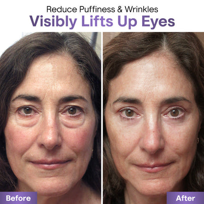 60 seconds to results - Liascy™ Eyebag Cream